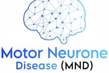 Illustrated outline of a human brain in blue with interconnected lines and dots, featuring the words “Motor Neurone Disease (MND) Awareness Day.”