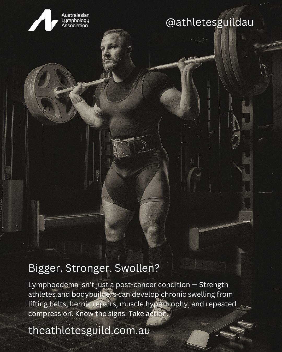 Strength athlete lifting a heavy barbell in squat rack, highlighting risks of lymphoedema for bodybuilders and strength sports.